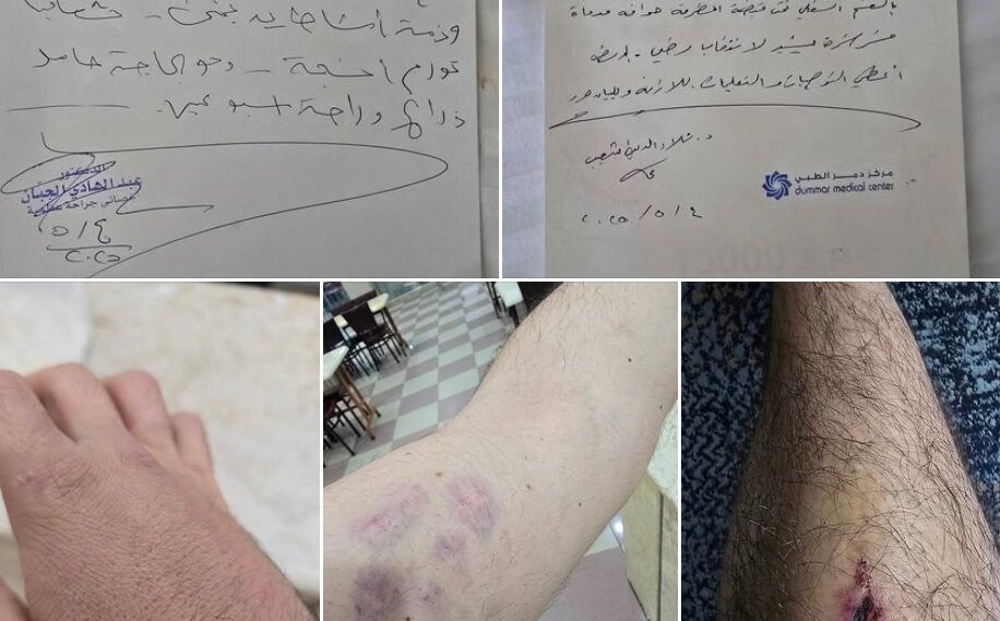 اعتداء وحشي في حمص: ناشط يكشف تفاصيل تعذيب على يد عناصر الأمن بسبب خطيبته