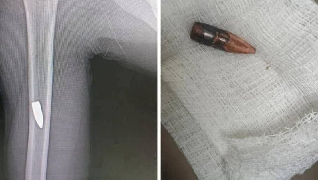 مأساة الفرح: قتلى وجرحى بـ"الرصاص الاحتفالي" في سوريا بعد أنباء رفع العقوبات