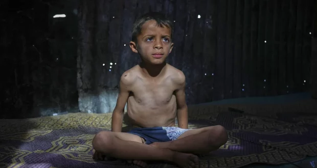 غزة: أطفال على شفير الموت جوعاً في ظل حصار خانق وتدهور كارثي للتغذية