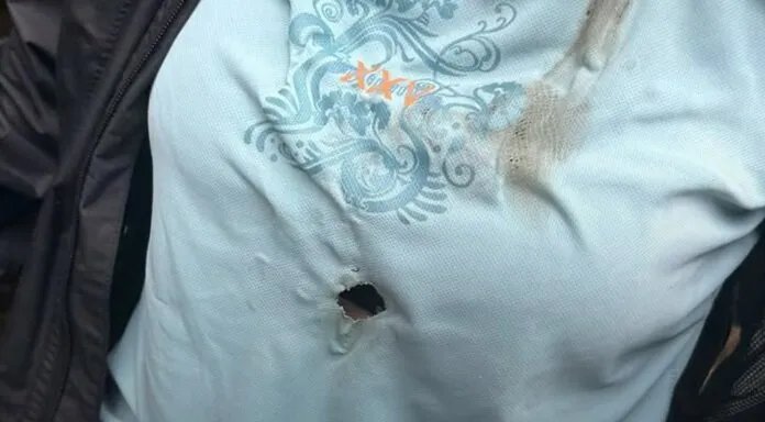 نجاة سائحة ألمانية بأعجوبة بعد صاعقة مباشرة في صدرها خلال رحلة مشي