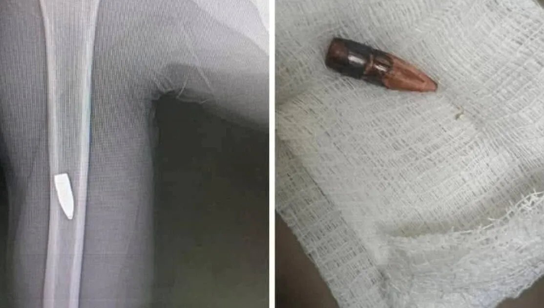 مأساة الفرح: قتلى وجرحى بـ"الرصاص الاحتفالي" في سوريا بعد أنباء رفع العقوبات