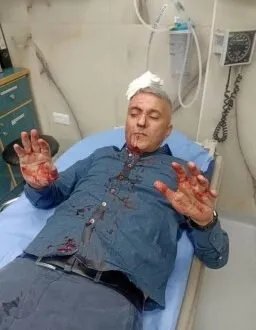 اعتداء على صحفي أردني في عمان يثير استنكاراً واسعاً وتحقيقاً حكومياً