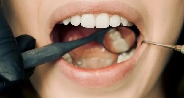 اكتشاف واعد في الفم: حمض نووي جديد "إينوكليز" قد يحد من خطر السرطان