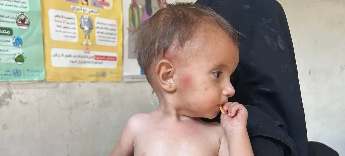 تحذير أممي: النظام الصحي في سوريا على شفا الانهيار بسبب نقص التمويل