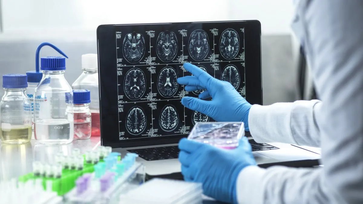 اكتشاف واعد: آلية بيولوجية جديدة لإبطاء تطور الزهايمر يكشفها باحثون نرويجيون