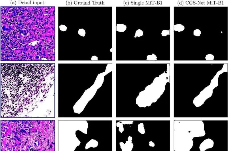 جامعة مين الأمريكية تحدث ثورة في تشخيص سرطان الثدي بنظام ذكاء اصطناعي متطور