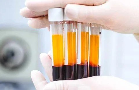 البلازما الغنية بالصفائح الدموية: حل طبيعي لتجديد شباب البشرة والشعر