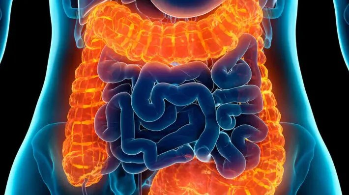 اكتشاف بكتيريا معوية قد تكون السبب وراء التهاب القولون التقرحي