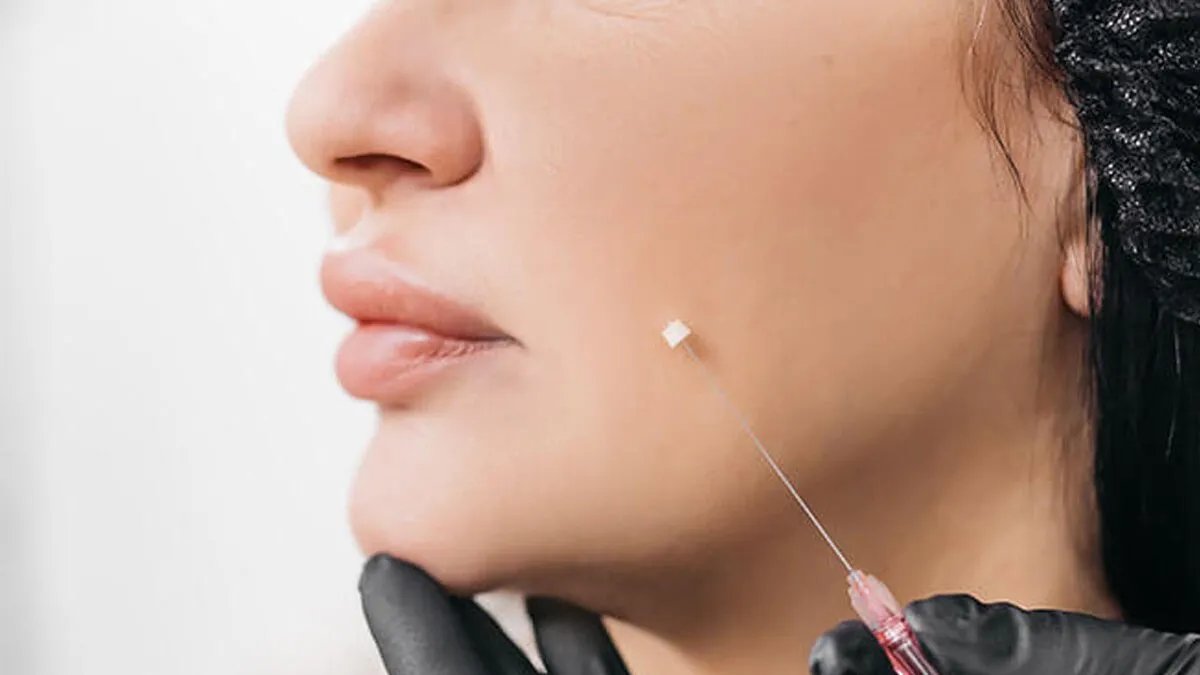 تجاوزات في مهنة طب الأسنان: "صيحات العصر" تثير قلق الصحة وتدفعها للتدخل