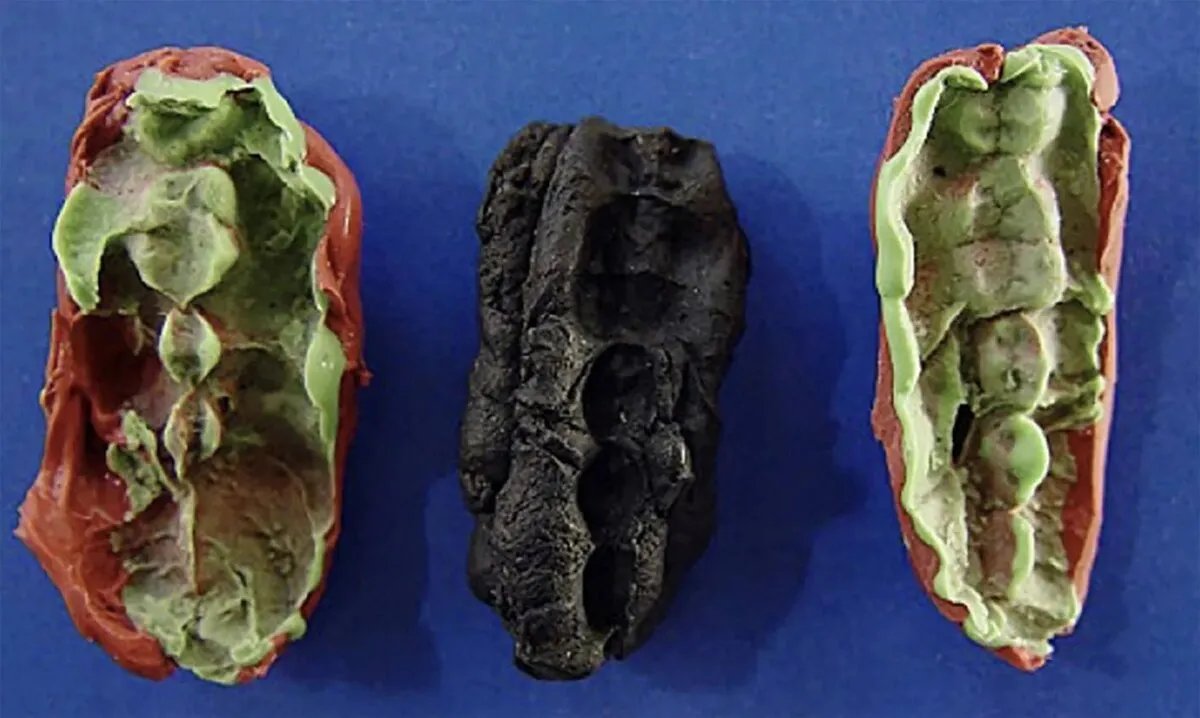 اكتشاف أثري مذهل: علكة عمرها 10 آلاف عام تكشف ملامح فتاة من العصر الحجري في إستونيا