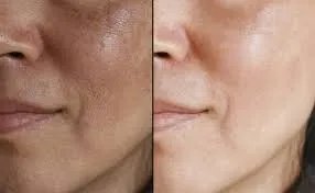 وداعًا للكلف والجفاف: بشرة مشرقة ومتألقة مع هذه الكريمات والسيرومات