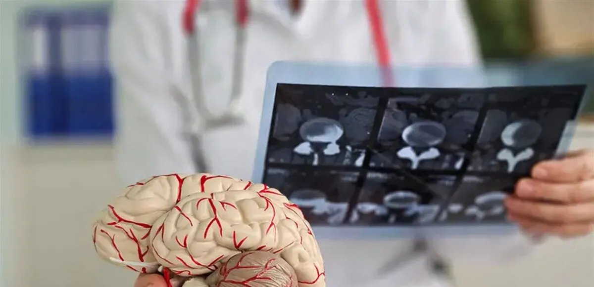 اكتشاف واعد: بروتين نانوي قد يحمي الدماغ من الزهايمر - آخر المستجدات العلمية