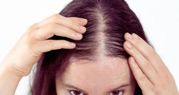 وداعاً لتساقط الشعر: أسباب وحلول للحفاظ على كثافة شعرك
